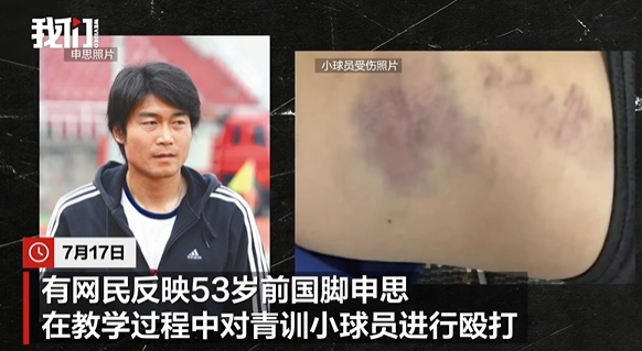 申思掌掴小球员后续:俱乐部称其顾问身份,家长已报警